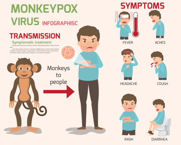 Tout savoir sur la variole du singe: symptômes et diagnostic.